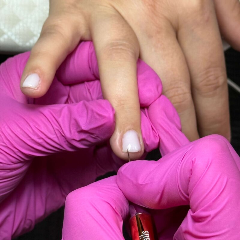 NN Treatment workshop Iris 12