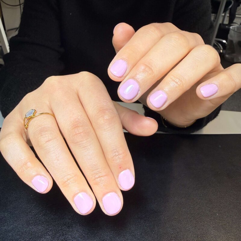 NN Treatment workshop Iris 16