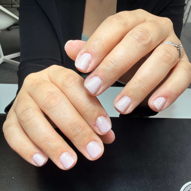 NN Treatment workshop Iris 17