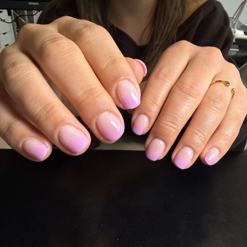 NN Treatment workshop Iris 18