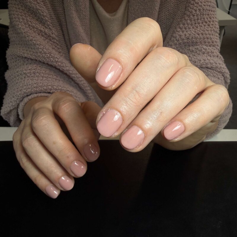 NN Treatment workshop Iris 19