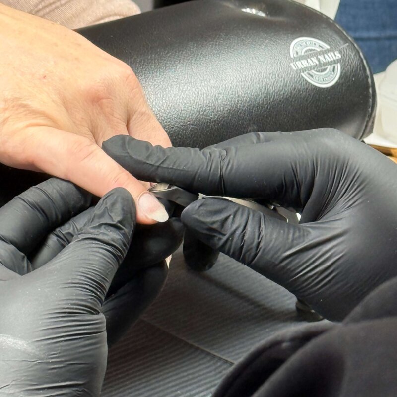 NN Treatment workshop Iris 2