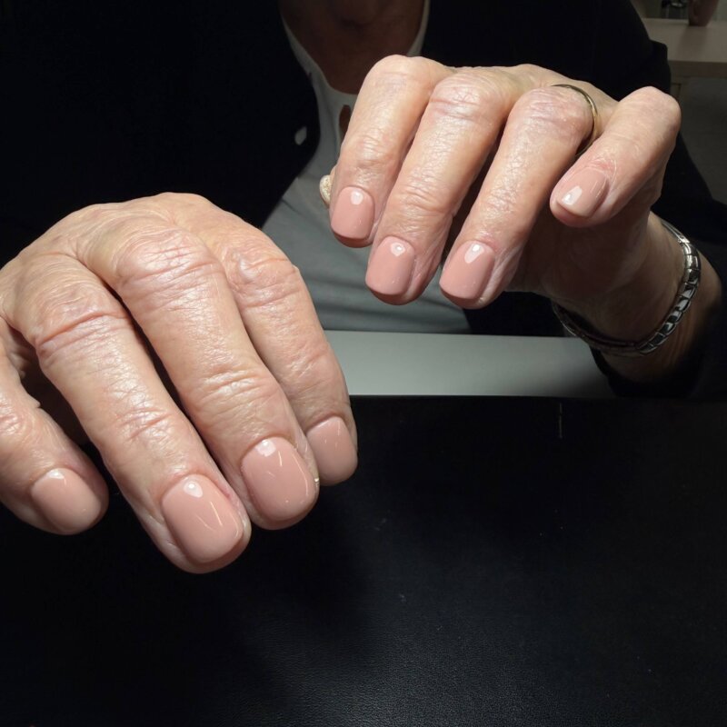 NN Treatment workshop Iris 20