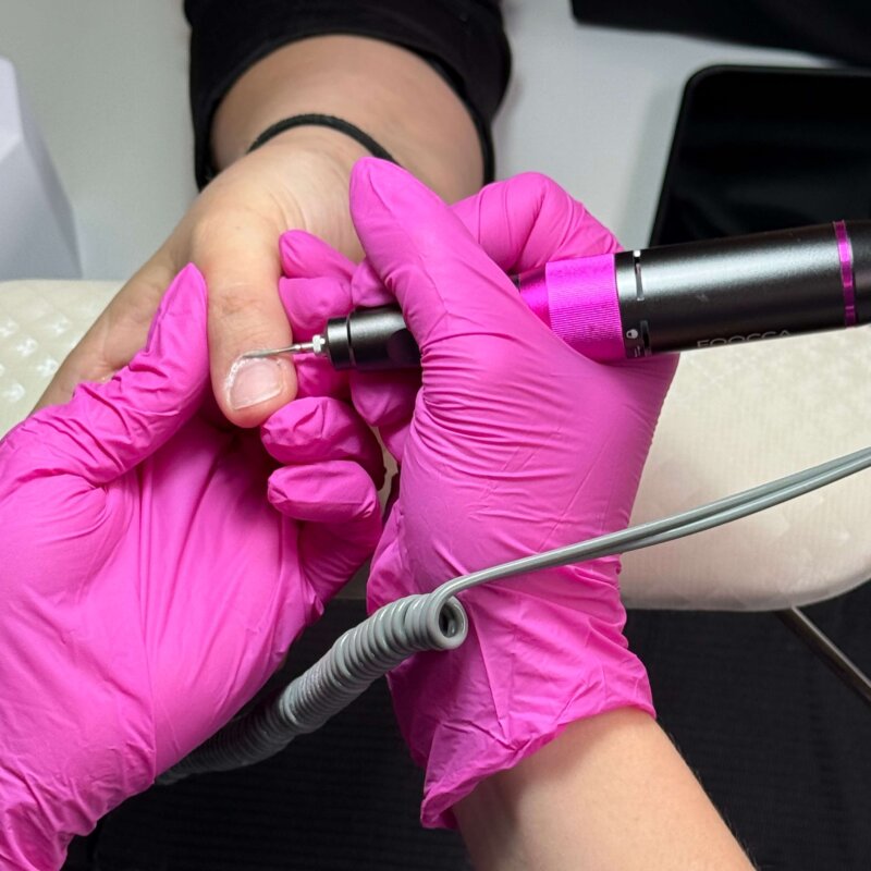 NN Treatment workshop Iris 4