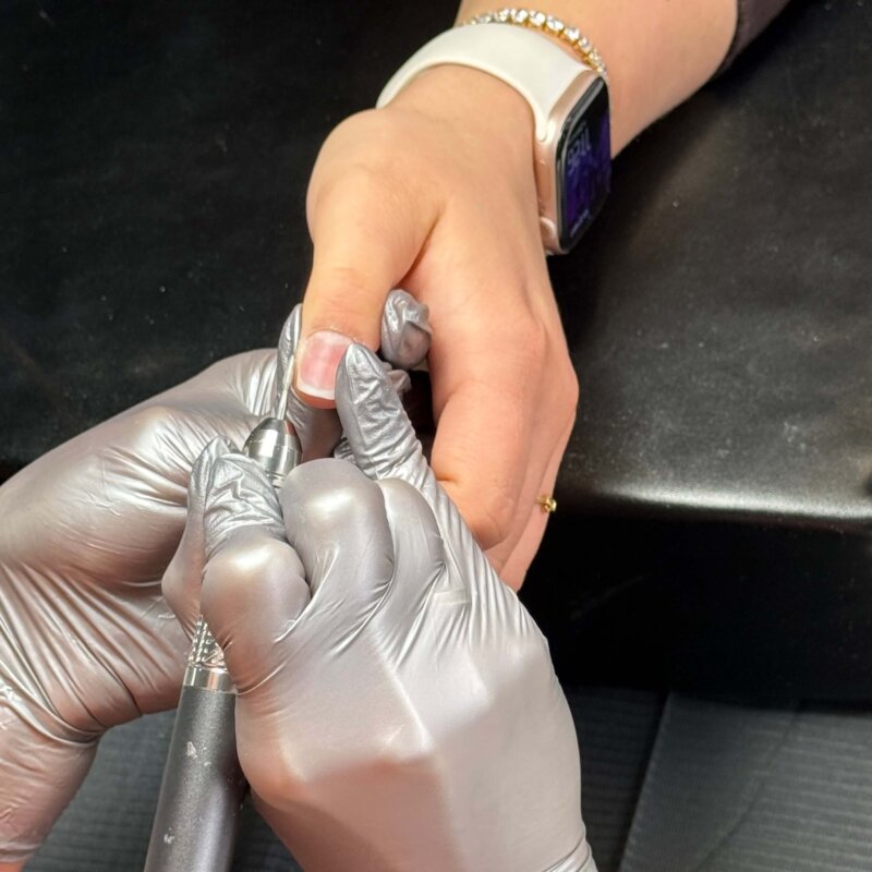 NN Treatment workshop Iris 6