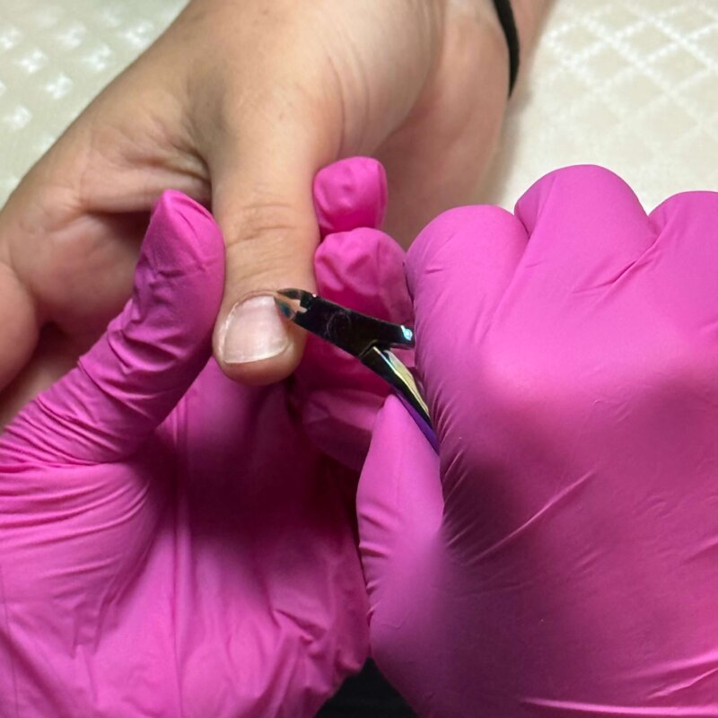 NN Treatment workshop Iris 7