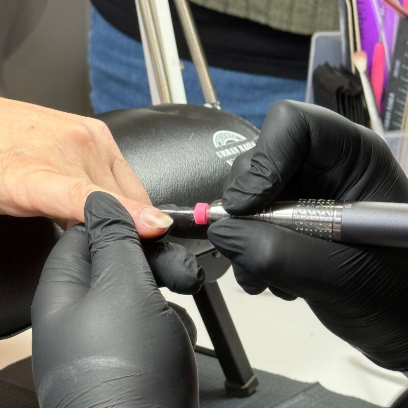 NN Treatment workshop Iris