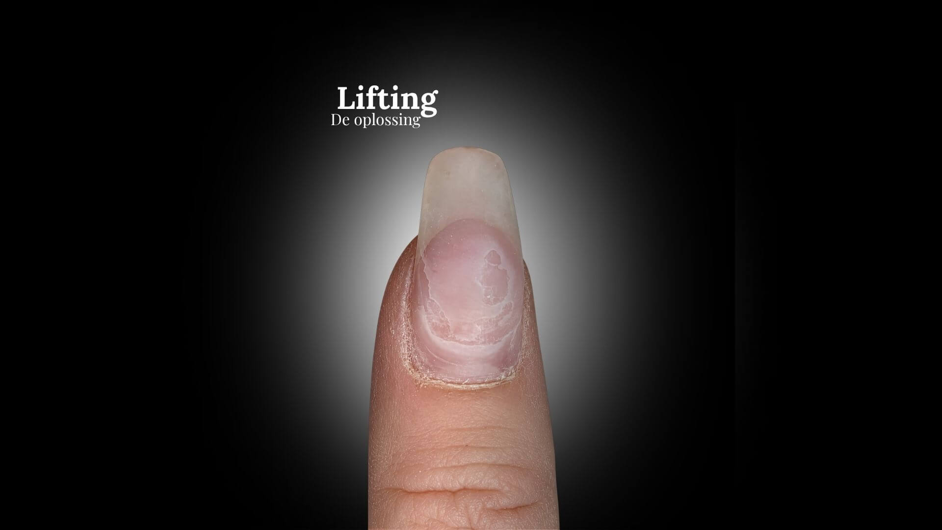 lifting oplossen